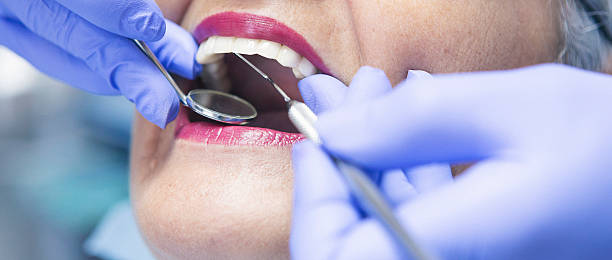 Best Emergency Dentist for Lost Fillings or Crowns in Newark, CA